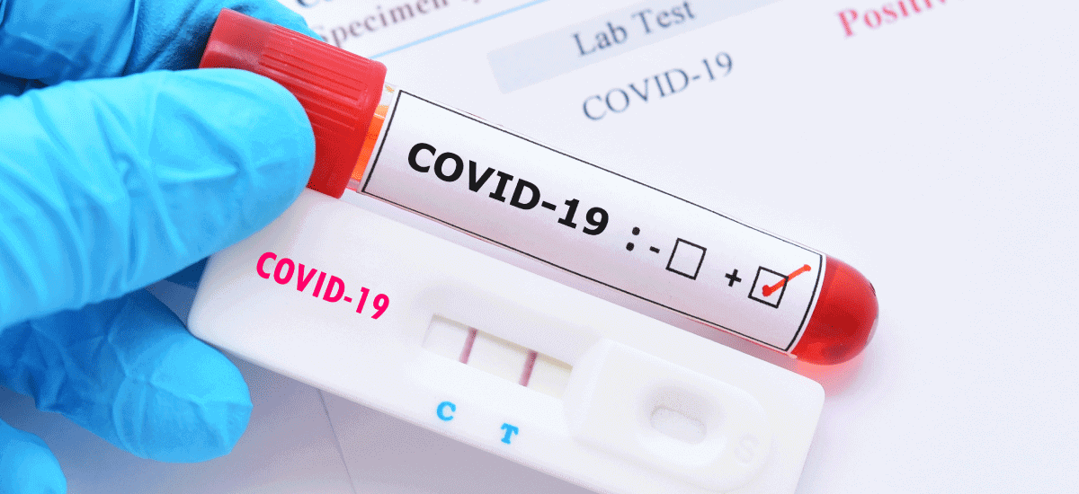 How to avail COVID-19 Test for Free of Cost in India - Acko How to avail COVID-19 Test for Free of Cost in India - Acko